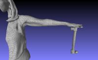 Lymphedema App Makes Point Cloud