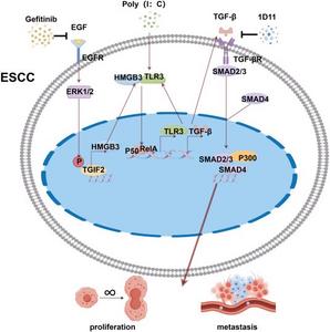 TGIF2-mediated HMGB3 overexpression promotes esophageal squamous cell carcinoma proliferation and metastasis through TLR3/TGF-β signaling