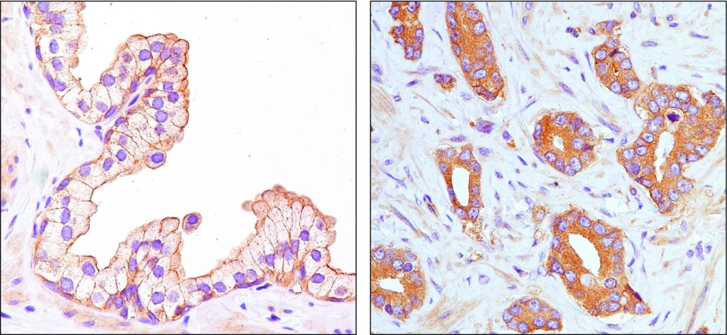 AIM1 Proteins