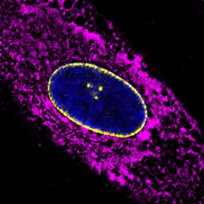 Salk Institute -- Fibroblast Marker