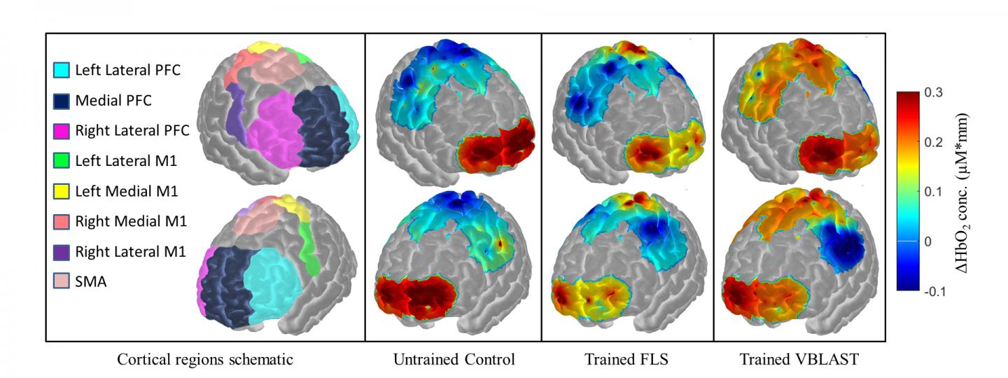 Brain Mapping