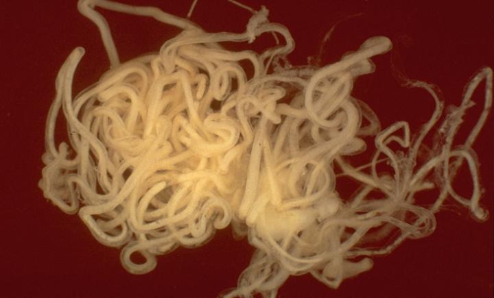 Worm Identified as Potential Cause for Mysterious Seizure Disorder (1 of 3)