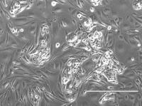 Early Patient-Derived Cell Lines