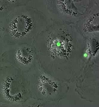 Vomocytosis of Live Pathogens from Macrophages is Regulated by the Atypical MAP Kinase ERK5