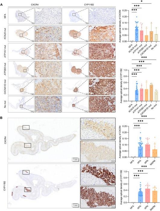 CXCR4 is highly expressed in aldosterone-producing lesions.