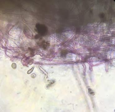 Protist video