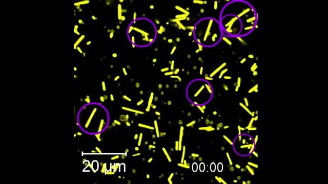 Video Showing How Bacteria Change Their Shape