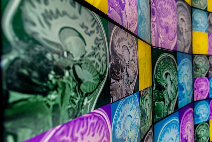 Brain scan images Thompson Institute