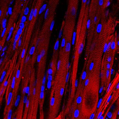 Striated Human Muscle