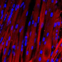Striated Human Muscle
