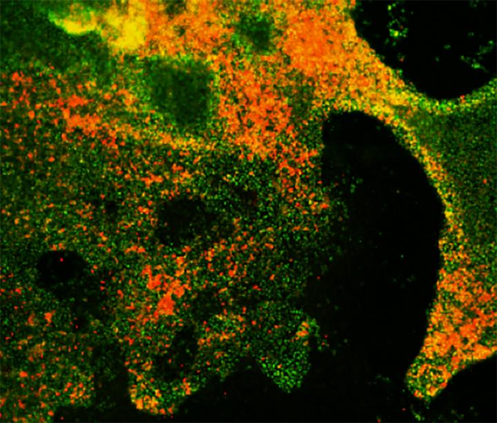 Formation of Neuroendocrine Cells from Lung Progenitors