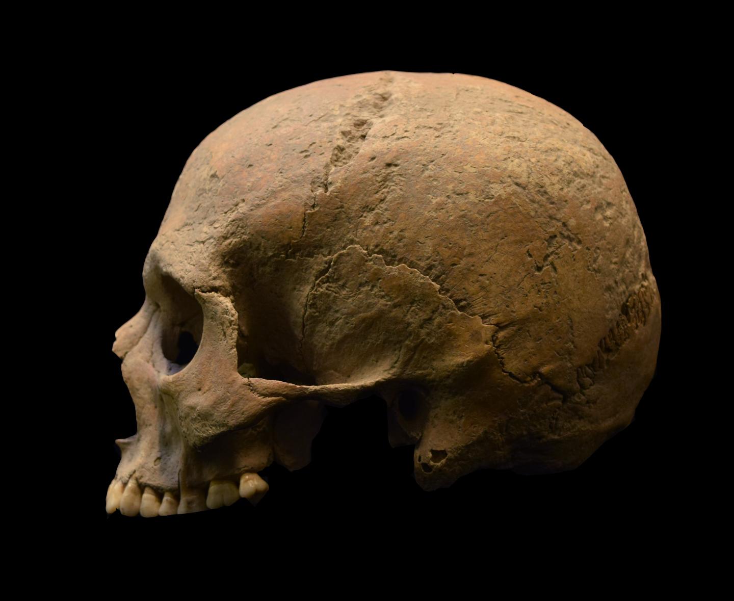 Skeletal Remains