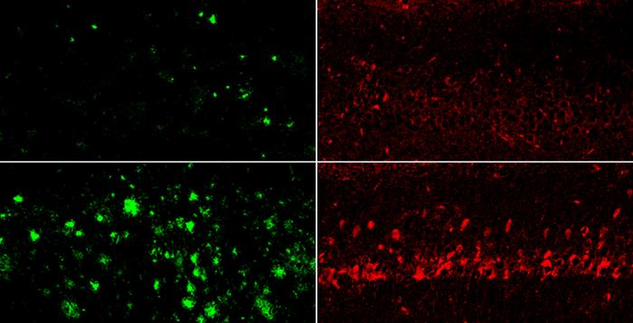 A new lithium compound evades amyloid capture, reverses Alzheimer's signs