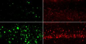 A new lithium compound evades amyloid capture, reverses Alzheimer's signs