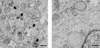 ASM Clogs Neuron