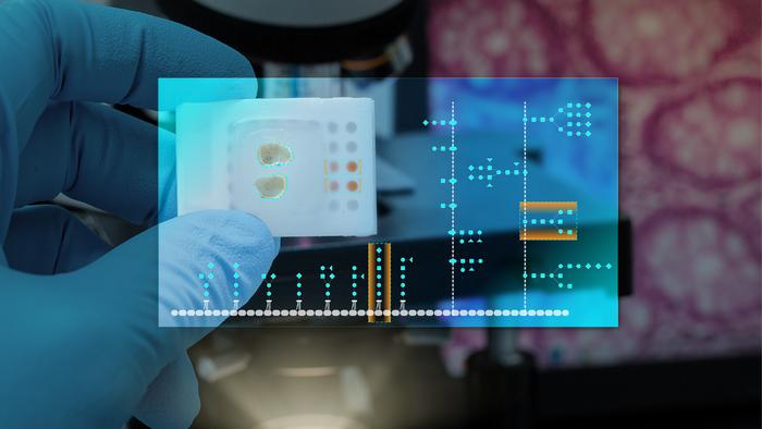 Cancer’s hidden sugar code opens diagnostic opportunities