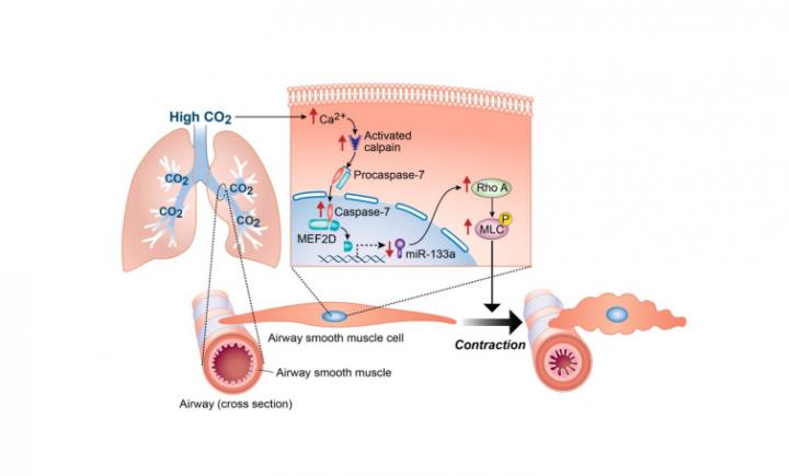 Excess Carbon Dioxide Promotes Airway Constriction in COPD (1 of 1)