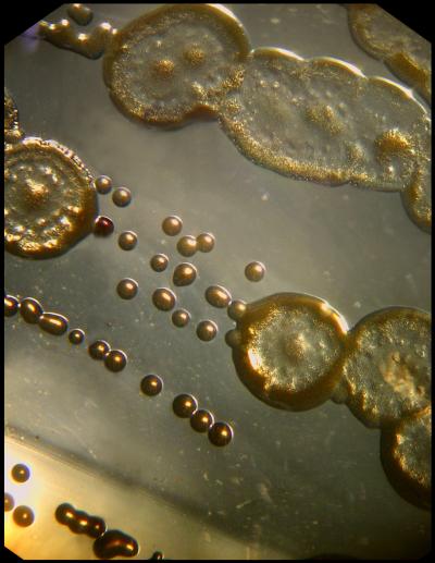 Secrets of Antibiotic Resistance Unlocked (6 of 9)