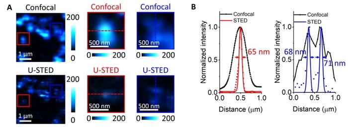 Figure 3 | U-STED microscopy of core–shell UCNPs with topology-driven ETNs.