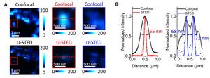 Figure 3 | U-STED microscopy of core–shell UCNPs with topology-driven ETNs.