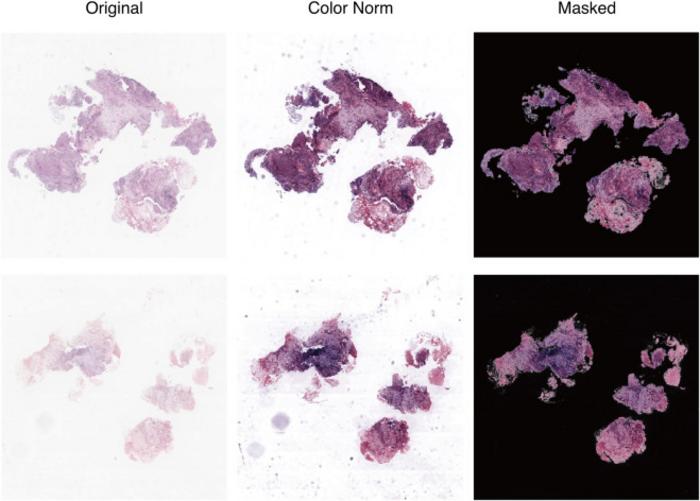 PolyU develops AI-powered virtual patient simulation system integrating multimodal data to advance personalised cancer treatment