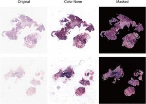 PolyU develops AI-powered virtual patient simulation system integrating multimodal data to advance personalised cancer treatment