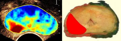 Prostate Images (1 of 2)