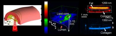 Vibrational Photoacoustic