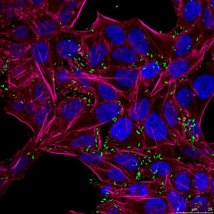 <em>Campylobacter</em> Infect Human Cells