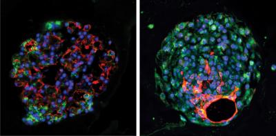 Lung Organoids