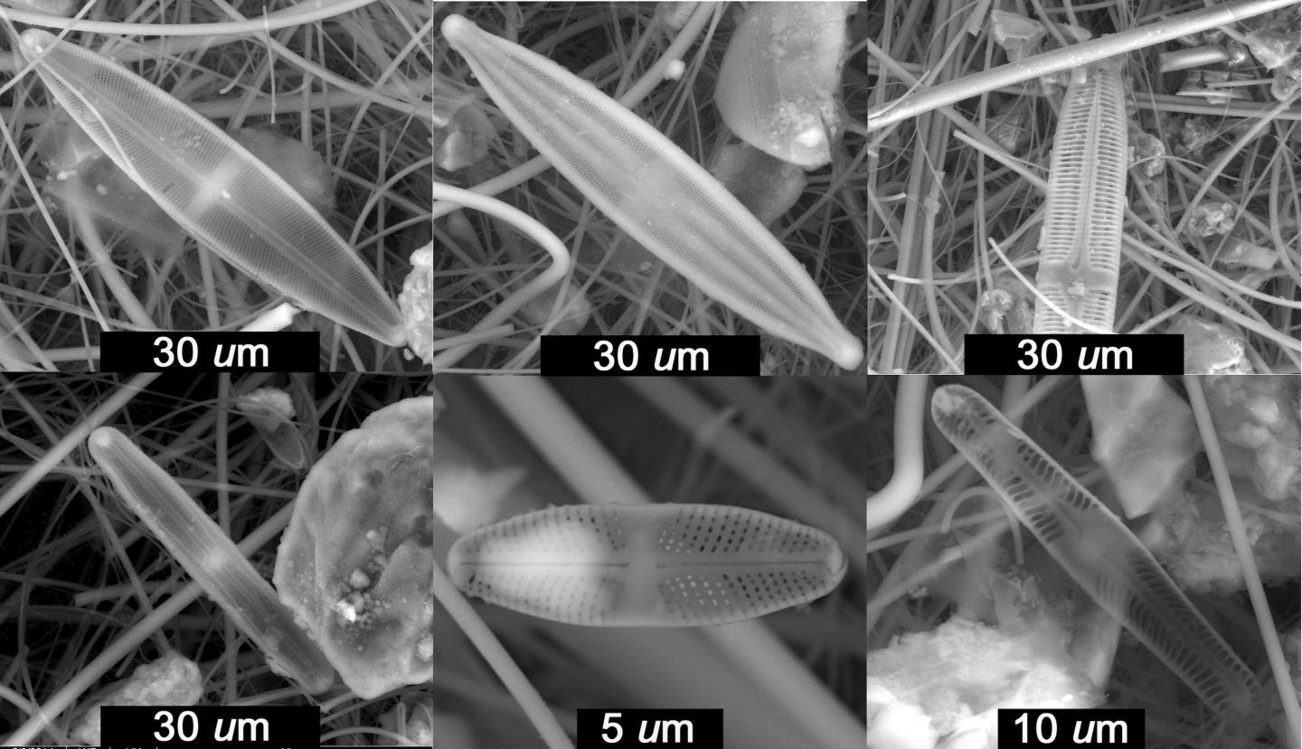 Diatom (1 of 3)