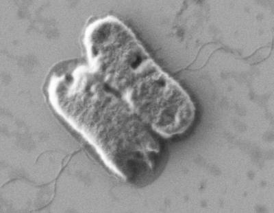 Bile Salts Send 'Mixed' Signals to E. coli O157:H7 Bacteria