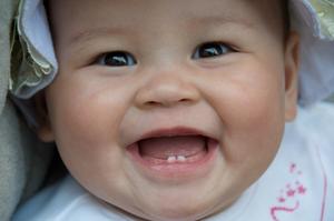 New tooth formation in a baby