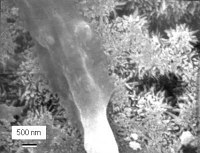 Layered Approach May Yield Stronger, More Successful Bone Implants 1 (of 2)