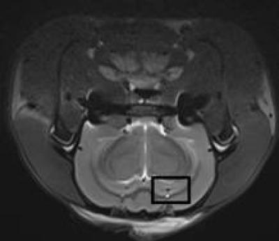 MRI T2