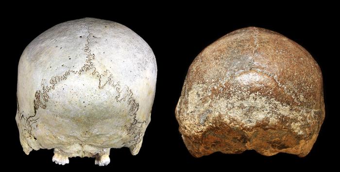 Cranial deformation in historical modern human and H. erectus