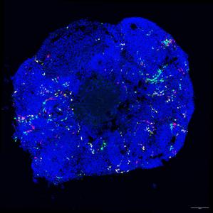 MADM organoid