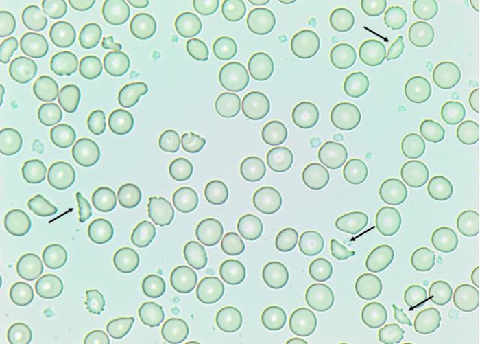 Fig1