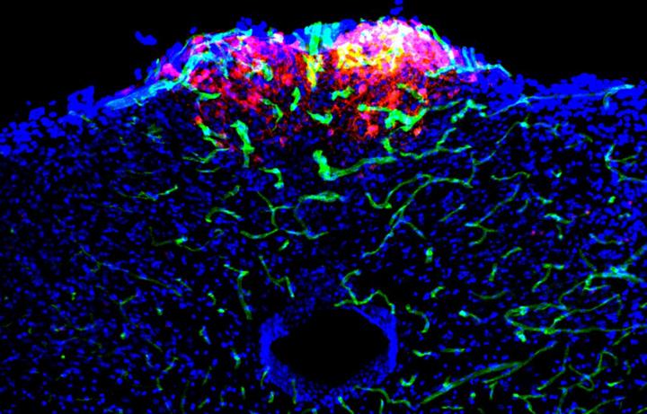 Nausea neurons