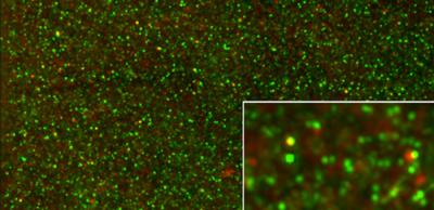 Activated PAK Gathers at Synapses