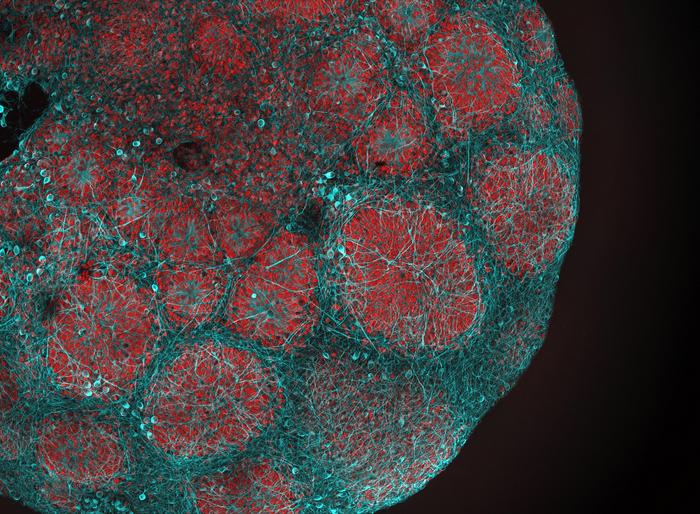 Brain organoid © HHU | Stephanie Le, AG Prigione