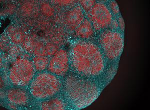 Brain organoid © HHU | Stephanie Le, AG Prigione