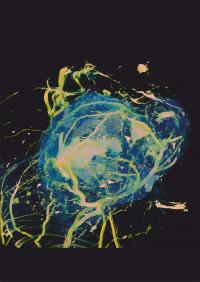 Tumors