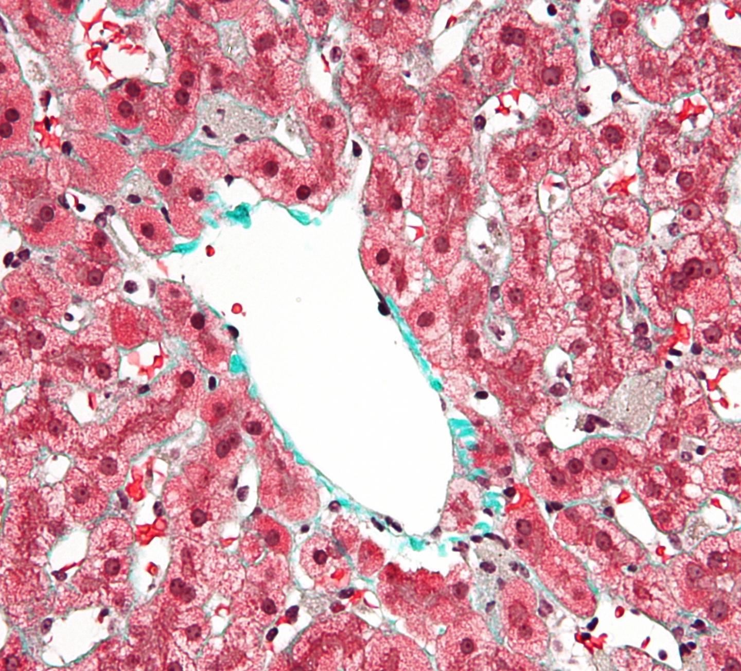 Liver Kupffer Cells