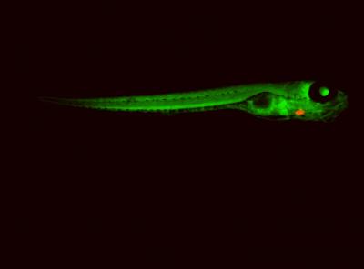 Zebrafish Study with Human Heart Implications (1 of 2)