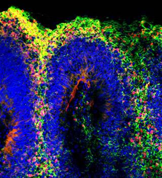 Zika Virus Organoids