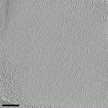 Cryo-ET Close-Up of the Pyrenoid