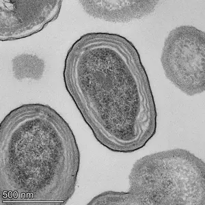 Prochlorococcus