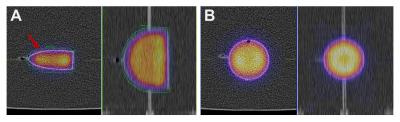 SPECT/CT Reconstructions and VOIs