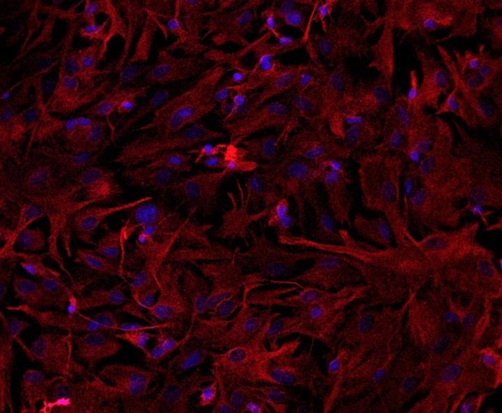 Astrocytes in Culture